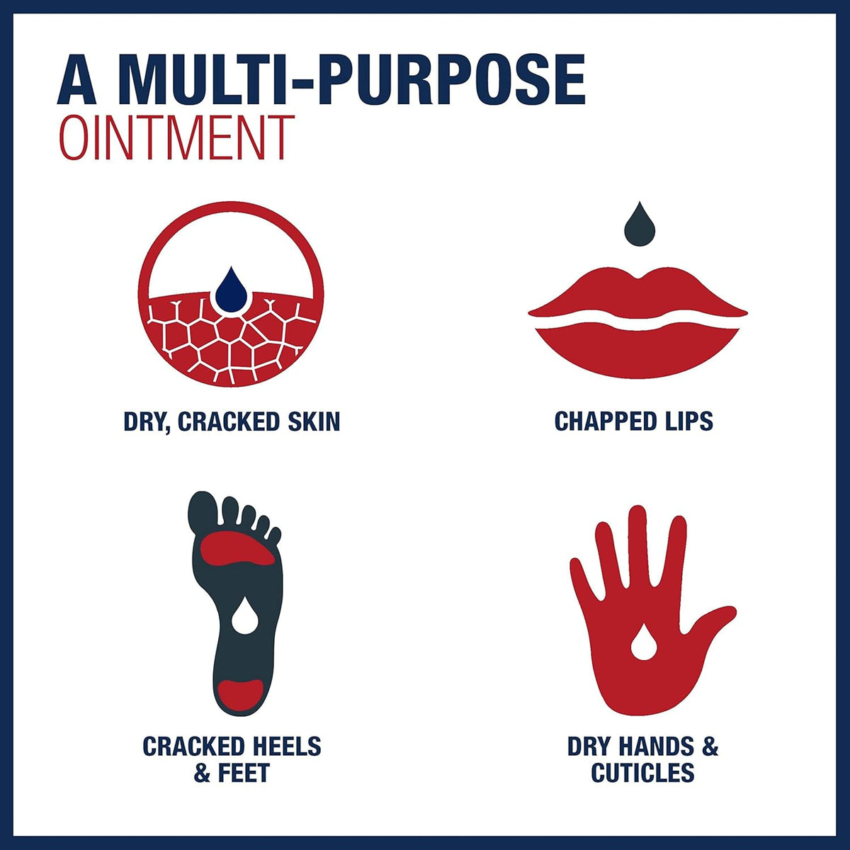 Aquaphor Healing Ointment Advanced Therapy Skin Protectant – Practical Housewarming Gift for New Homeowners and Hostesses, 0.75 Oz Pack of 4