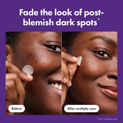 Hero Cosmetics Mighty Patch Hero Micropoint Spot Treatment – Beautiful Housewarming Present for the Friend Who Loves Beauty