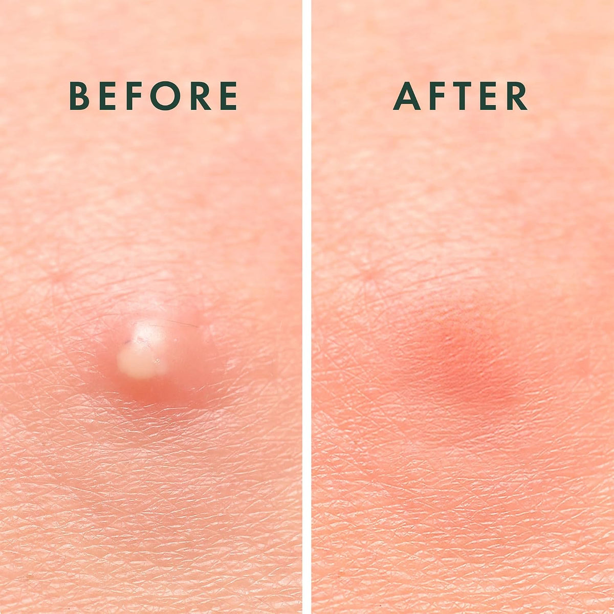 hypoallergenic, non-drying formulation safe for all skin types