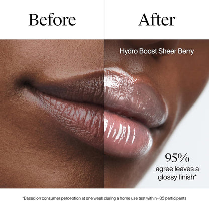Neutrogena Hydro Boost Hyaluronic Acid Lip Balm – All-Skin-Type Daily Treatment, Dermatologist-Backed Formula for Sensitive Lips