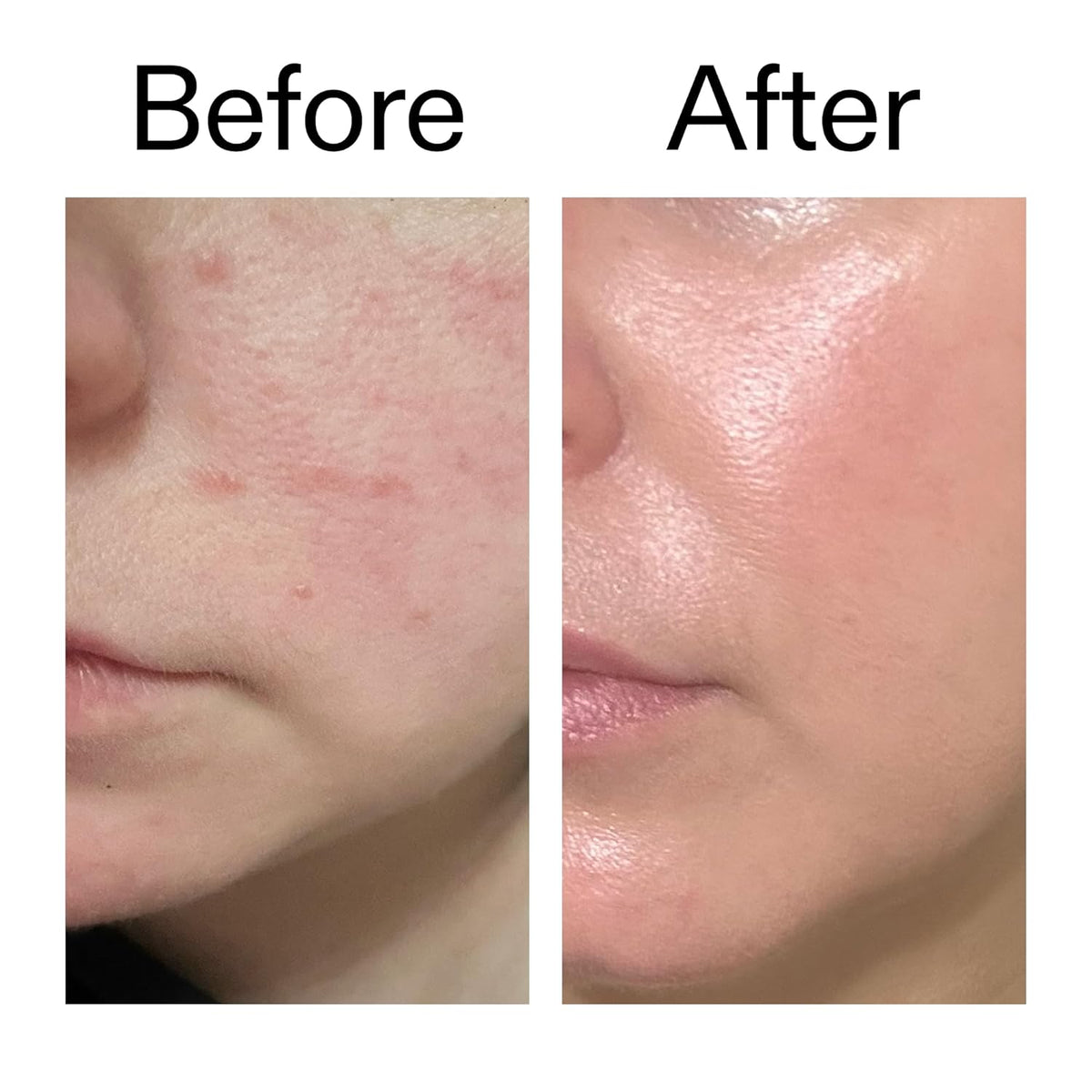 The INKEY List Exosome Hydro-Glow Complex – Less-Is-More Hydrator for Minimalist Bathroom, Multi-Tasking Anti-Dullness Formula